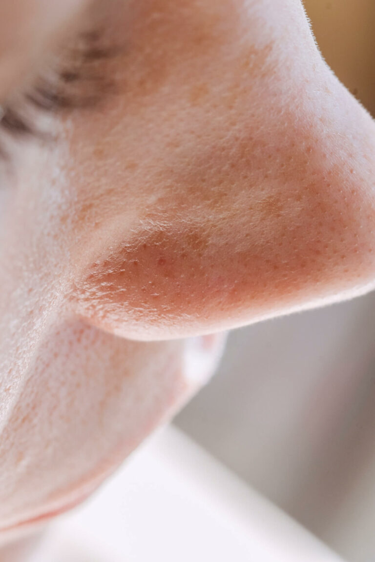 3 einfache Tipps gegen große Poren im Gesicht - Face Gym